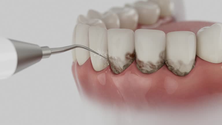 Trusted Teeth Cleaning And Checkup service in Oak Ridge, NJ - Dentist Open Now